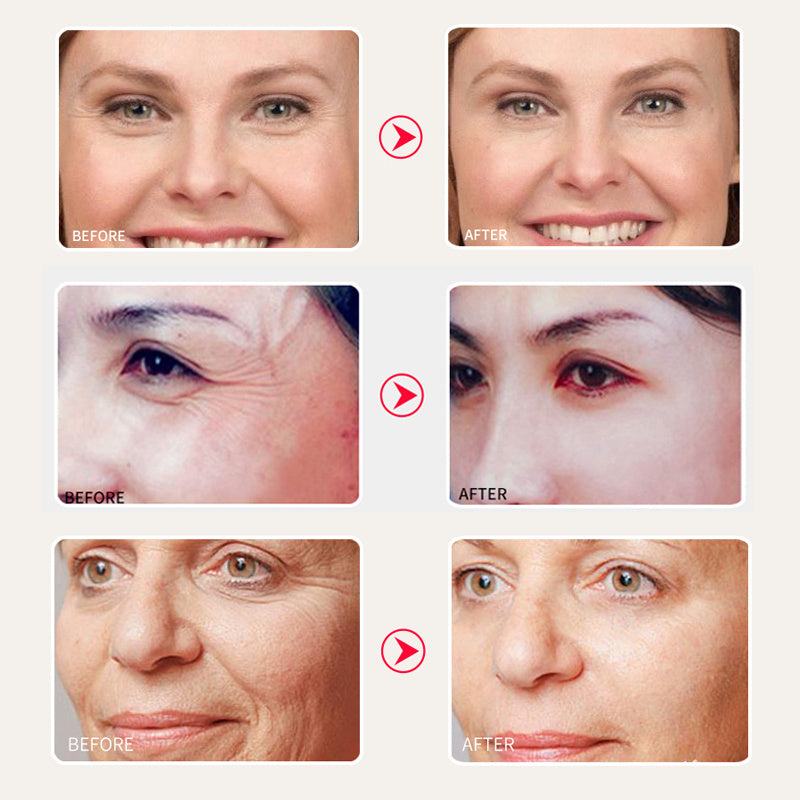 Snail Moisturizing Cream – Deep Hydration & Skin Repair (Schnecken-Crème – Intensive Pflege & Hautregeneration)